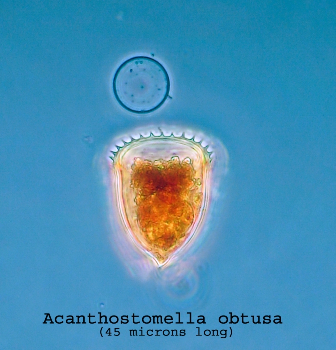 Acanthostomella obtusa Acanthostomella obtusa