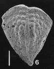 Inflatobolivinella subrugosa (Butt) GAMONT