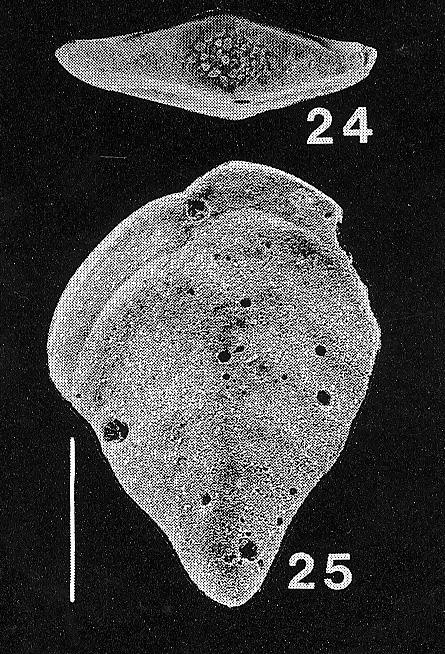 Inflatobolivinella virgata (Cushman)