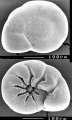 Chromista - Foraminifera (foraminifers)