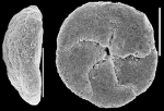 Chromista - Foraminifera (foraminifers)