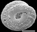 Chromista - Foraminifera (foraminifers)