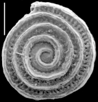 Chromista - Foraminifera (foraminifers)