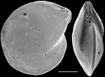 Chromista - Foraminifera (foraminifers)