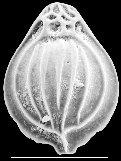Fissurina clathrata New Zealand Fissurina clathrata New Zealand