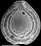 Chromista - Foraminifera (foraminifers)