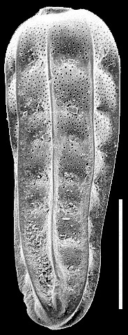 Siphogenerina raphana New Zealand Siphogenerina raphana New Zealand