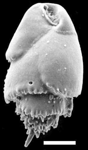 Bulimina marginata f. marginata New Zealand Bulimina marginata f. marginata New Zealand