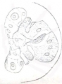 Platyhelminthes (flatworms)