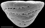 Chromista - Foraminifera (foraminifers)