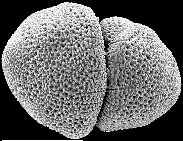 Glabratellina kermadecensis New Zealand paratype plastogammic pair