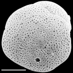 Chromista - Foraminifera (foraminifers)