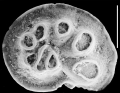 Chromista - Foraminifera (foraminifers)