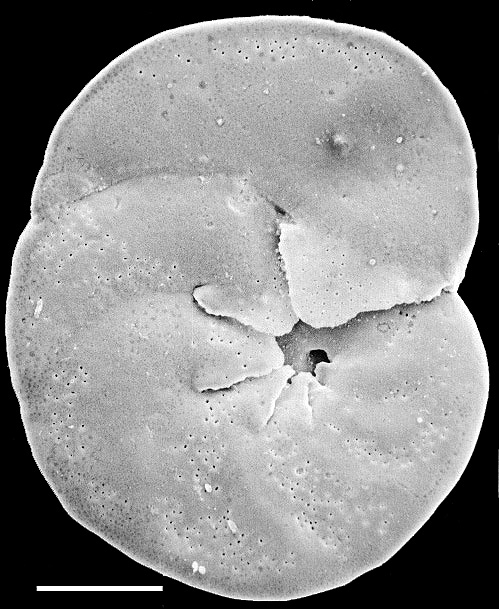 Discorbinella bertheloti New Zealand Discorbinella bertheloti New Zealand