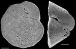 Chromista - Foraminifera (foraminifers)