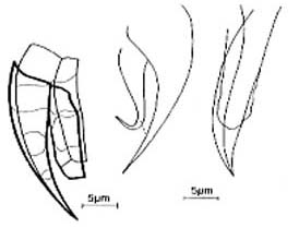 Karkinorhynchus bruneti