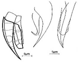 Karkinorhynchus bruneti Karkinorhynchus bruneti