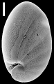 Chromista - Foraminifera (foraminifers)