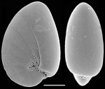 Chromista - Foraminifera (foraminifers)