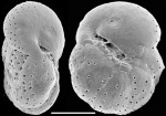 Chromista - Foraminifera (foraminifers)