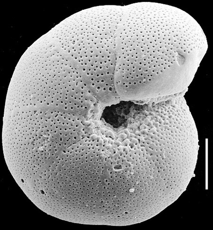 Anomalinoides sphericus New Zealand