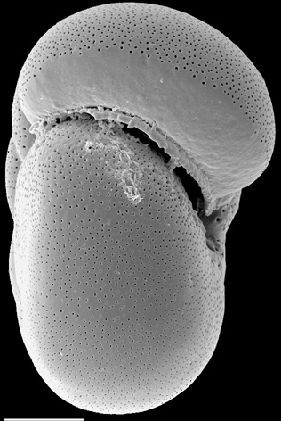 Anomalinoides sphericus New Zealand Anomalinoides sphericus New Zealand