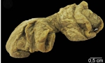 Plakortis spinalis