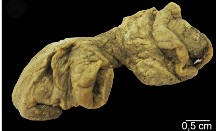 Plakortis spinalis Plakortis spinalis
