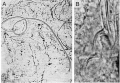 Platyhelminthes (flatworms)