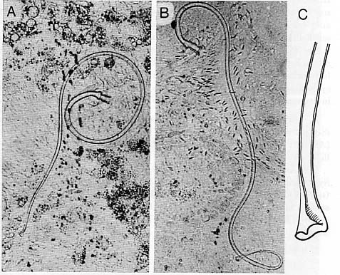 Promesostoma gracilis