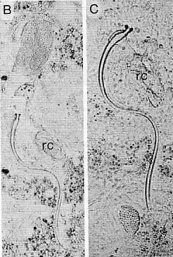 Promesostoma serpentistylum