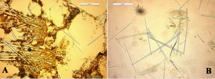 Clathria toxitenuis spicules