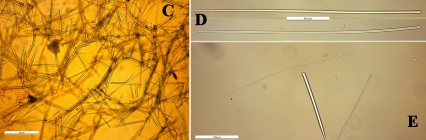 Clathria toxistricta skeleton and spicules