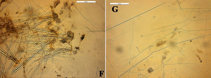 Clathria toximajor skeleton and spicules