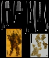 Porifera (sponges)