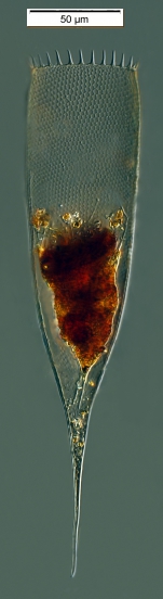 Parafavella elegans