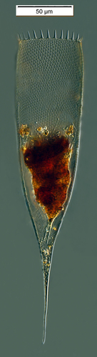 Parafavella elegans