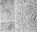 Platyhelminthes (flatworms)