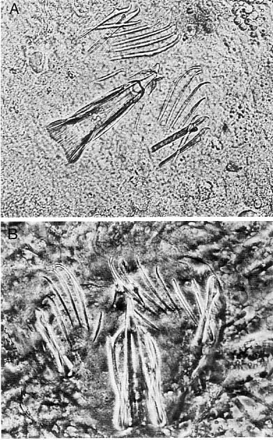 Coelogynopora cassida Coelogynopora cassida