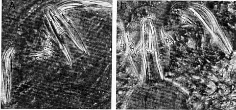 Coelogynopora forcipis Coelogynopora forcipis