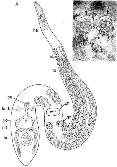 Coelogynopora gynocotyla