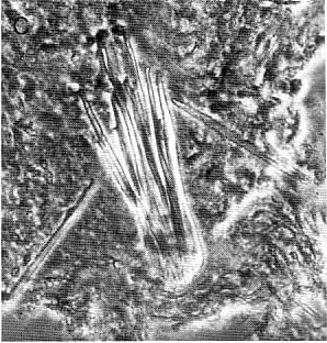 Coelogynopora hamulis Coelogynopora hamulis