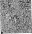 Platyhelminthes (flatworms)