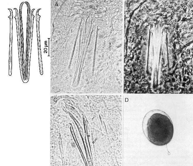 Coelogynopora sequana Coelogynopora sequana