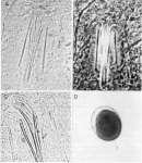 Coelogynopora sequana