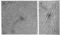 Platyhelminthes (flatworms)