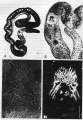 Platyhelminthes (flatworms)