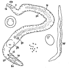 Coelogynopora alata