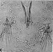 Coelogynopora erotica Coelogynopora erotica