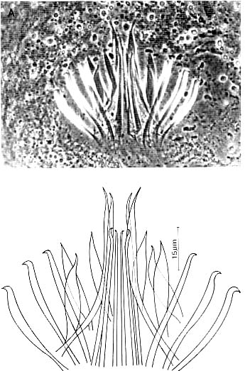 Coelogynopora frondifera Coelogynopora frondifera